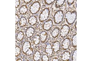 IHC analysis of SNRNP27 using anti-SNRNP27 antibody (ABIN7599614). (SNRNP27 antibody  (AA 100-155))