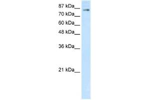 SMARCA3 antibody (20R-1195) used at 0.