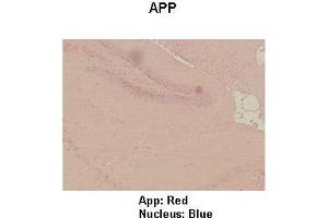 Sample Type : Mouse hippo campus  Primary Antibody Dilution :  1:100  Secondary Antibody: Anti-rabbit-HRP  Secondary Antibody Dilution:  1:300  Color/Signal Descriptions: App: Red Nucleus: Blue  Gene Name: APP  Submitted by: Teresa Gunn (APP antibody  (Middle Region))
