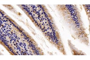 Immunohistochemistry (IHC) image for anti-Catalase (CAT) (AA 401-523) antibody (ABIN7434887)