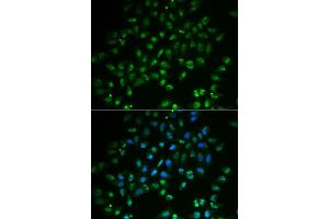 Immunofluorescence analysis of  cells using H antibody (ABIN6128002, ABIN6141597, ABIN6141598 and ABIN6222828). (HAND2 antibody  (AA 1-217))