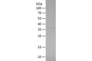 Smooth Muscle Actin Protein (AA 3-100) (His-IF2DI Tag)