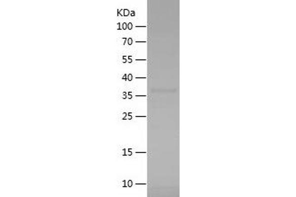 Smooth Muscle Actin Protein (AA 3-100) (His-IF2DI Tag)