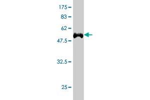 Western Blot detection against Immunogen (54. (TARDBP antibody  (AA 1-260))