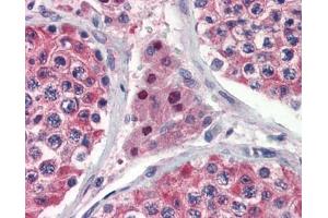 IDH1 antibody was used for immunohistochemistry at a concentration of 4-8 ug/ml. (IDH1 antibody)
