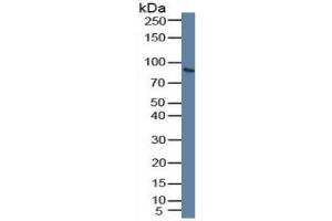 Rabbit Capture antibody from the kit in WB with Positive Control: Human blood cells. (PLG CLIA Kit)