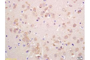 Formalin-fixed and paraffin embedded rat brain labeled with Anti-VGLUT2 Polyclonal Antibody, Unconjugated  at 1:200 followed by conjugation to the secondary antibody and DAB staining. (Solute Carrier Family 17 (Vesicular Glutamate Transporter), Member 6 (SLC17A6) (AA 1-50) antibody)