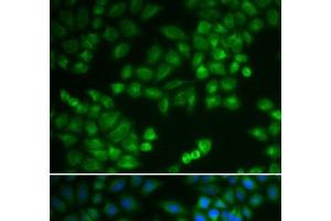 Immunofluorescence analysis of MCF-7 cells using RPL5 Polyclonal Antibody (RPL5 antibody)