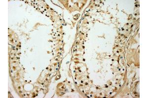 IHC(P): Human Testis Tissue (ODC1 antibody)