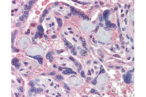 Anti-NCOA3 antibody IHC of human placenta. (NCOA3 antibody  (AA 188-198))