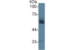 Detection of AGT in Rat Liver lysate using Polyclonal Antibody to Angiotensinogen (AGT) (AGT antibody  (AA 25-477))