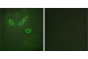 Immunofluorescence (IF) image for anti-Tumor Suppressor Candidate 5 (TUSC5) (AA 1-50) antibody (ABIN2889667)