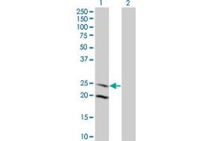 Western Blot analysis of IL6 expression in transfected 293T cell line by IL6 monoclonal antibody (M09), clone 3F12. (IL-6 antibody  (AA 29-212))