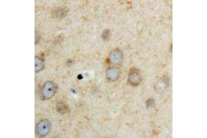 Immunohistochemical analysis of SPHK2 staining in human brain formalin fixed paraffin embedded tissue section. (SPHK2 antibody  (C-Term))