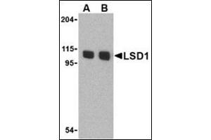 Western blot analysis of LSD1 in P815 cell lysate with this product at (A) 1 and (B) 2 μg/ml. (LSD1 antibody  (N-Term))