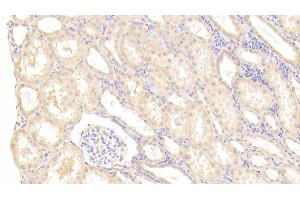 Detection of MMP1 in Human Kidney Tissue using Polyclonal Antibody to Matrix Metalloproteinase 1 (MMP1) (MMP1 antibody  (AA 98-275))