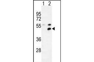 Western blot analysis of P1 (arrow) using rabbit polyclonal P1 Antibody (Center) (ABIN654665 and ABIN2844361). (MPP1 antibody  (AA 301-327))