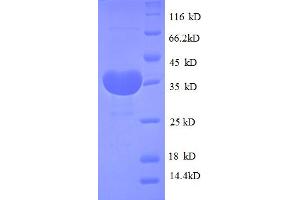 SDS-PAGE (SDS) image for Mitochondrially Encoded Cytochrome B (MT-CYB) (AA 1-98), (full length) protein (GST tag) (ABIN4974437)