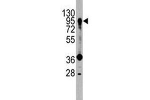 Western blot analysis of PROX1 antibody and HepG2 lysate. (PROX1 antibody  (AA 185-214))