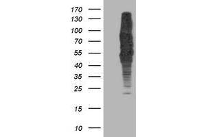 HEK293T cells were transfected with the pCMV6-ENTRY control (Left lane) or pCMV6-ENTRY DLD (Right lane) cDNA for 48 hrs and lysed. (DLD antibody)