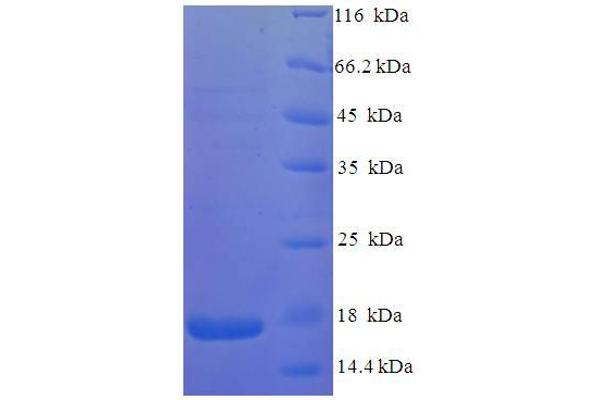 Vpx Protein (VPX) (AA 1-113), (full length) protein (His tag)