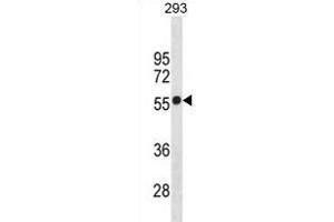 CB1 Antibody (Center) (ABIN1881140 and ABIN2838680) western blot analysis in 293 cell line lysates (35 μg/lane). (CNR1 antibody  (AA 161-187))