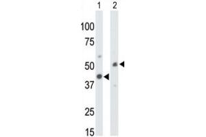 Western Blotting (WB) image for anti-Creatine Kinase, Mitochondrial 1, Ubiquitous (CKMT1) antibody (ABIN5022957) (CKMT1 antibody)