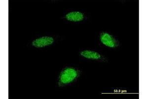 Immunofluorescence of monoclonal antibody to RPS6KB2 on HeLa cell. (RPS6KB2 antibody  (AA 1-100))