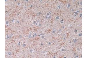 Detection of BNP in Human Cerebrum Tissue using Monoclonal Antibody to Brain Natriuretic Peptide (BNP) (BNP antibody)