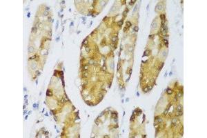 Immunohistochemistry of paraffin-embedded Human stomach using ERLIN1 Polyclonal Antibody at dilution of 1:100 (40x lens). (ERLIN1 antibody)