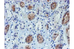 Immunohistochemistry (IHC) image for anti-Docking Protein 7 (DOK7) antibody (ABIN1497885) (DOK7 antibody)