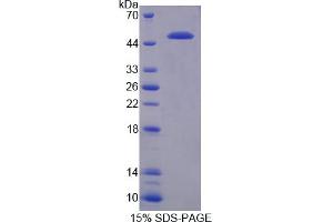 Image no. 1 for Toll-Like Receptor Adaptor Molecule 2 (TICAM2) (AA 20-196) protein (His tag,GST tag) (ABIN4990646) (TICAM2 Protein (AA 20-196) (His tag,GST tag))