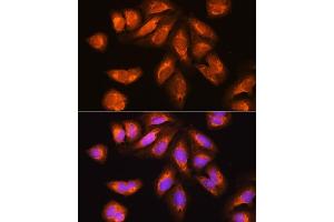 Immunofluorescence analysis of U2OS cells using EXOSC2 Rabbit pAb (ABIN6127886, ABIN6140374, ABIN6140375 and ABIN6214708) at dilution of 1:100. (EXOSC2 antibody  (AA 1-293))