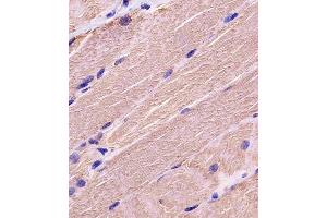 A staining MYBPC3 in human skeletal muscle tissue sections by Immunohistochemistry (IHC-P - paraformaldehyde-fixed, paraffin-embedded sections). (MYBPC3 antibody  (N-Term))