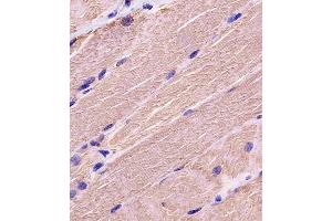 A staining MYBPC3 in human skeletal muscle tissue sections by Immunohistochemistry (IHC-P - paraformaldehyde-fixed, paraffin-embedded sections). (MYBPC3 antibody  (N-Term))