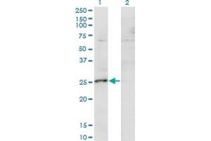 Western Blot analysis of MIS12 expression in transfected 293T cell line by MIS12 monoclonal antibody (M01), clone 1G3.