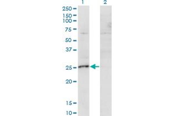 MIS12 Antikörper  (AA 1-205)