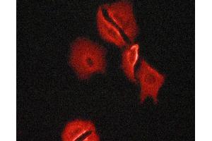 Tubulin alpha staining Human fetal heart cells by ICC/IF. (alpha Tubulin antibody)