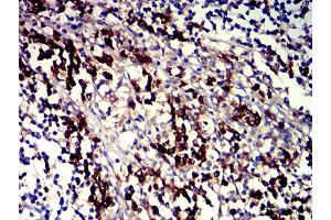 Immunohistochemical analysis of paraffin-embedded tonsil tissues using CD319 mouse mAb with DAB staining. (SLAMF7 antibody  (AA 23-226))