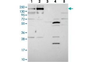 Western blot analysis of Lane 1: RT-4, Lane 2: U-251 MG, Lane 3: Human Plasma, Lane 4: Liver, Lane 5: Tonsil with TMEM2 polyclonal antibody  at 1:250-1:500 dilution. (TMEM2 antibody)