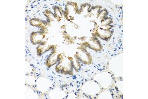 Immunohistochemistry of paraffin-embedded rat lung using S100A7 antibody (ABIN5974971) at dilution of 1/100 (40x lens). (S100A7 antibody)