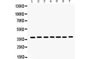 Western Blotting (WB) image for anti-Histone Deacetylase 11 (HDAC11) (AA 47-81), (N-Term) antibody (ABIN3043840) (HDAC11 antibody  (N-Term))