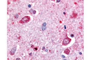 Anti-DPP6 antibody IHC of human brain, neurons. (DPP6 antibody  (Extracellular Domain))