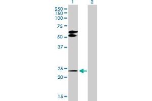 Western Blot analysis of TGIF2 expression in transfected 293T cell line by TGIF2 MaxPab polyclonal antibody.