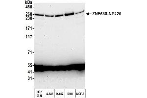 Western Blotting (WB) image for anti-Zinc Finger Protein 638 (ZNF638) (AA 1928-1978) antibody (ABIN7450948)