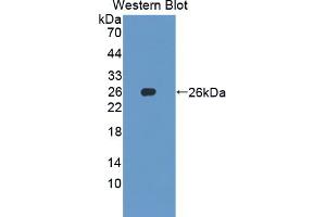 Figure. (SKP1 antibody  (AA 1-163))