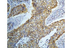 IHC analysis of DARS2 using anti-DARS2 antibody (ABIN6719279).