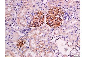 Paraformaldehyde-fixed, paraffin embedded mouse kidney tissue, Antigen retrieval by boiling in sodium citrate buffer(pH6) for 15min, Block endogenous peroxidase by 3% hydrogen peroxide for 30 minutes, Blocking buffer (normal goat serum) at 37°C for 20min, Antibody incubation with Rabbit Anti-Podocin Polyclonal Antibody, Unconjugated  at 1:200 overnight at 4°C, followed by a conjugated secondary and DAB staining (Podocin antibody  (AA 231-330))