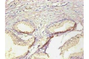 Immunohistochemical of paraffin-embedded human prostate tissue using ABIN7161512 at dilution of 1:200 (Lipocalin 2 antibody)