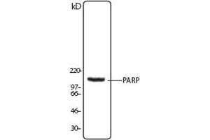 Image no. 1 for anti-Poly (ADP-Ribose) Polymerase 1 (PARP1) (N-Term) antibody (ABIN307559) (PARP1 antibody  (N-Term))